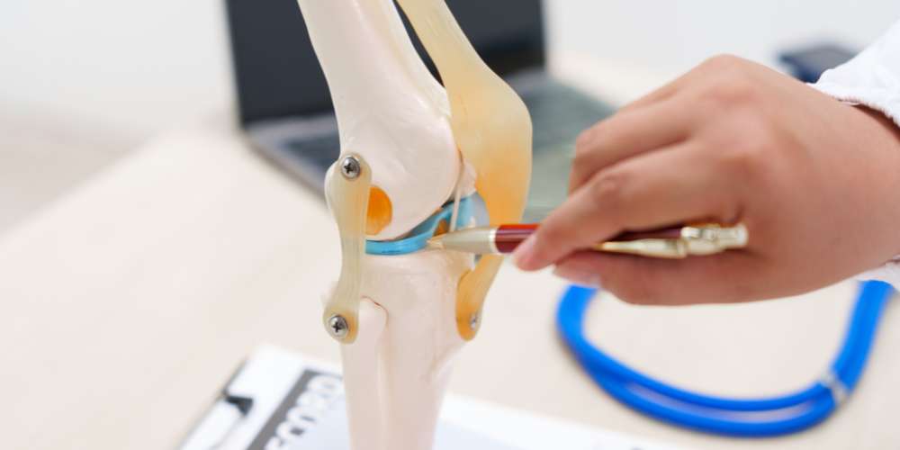 L'arthrose du genou : comprendre, traiter et prévenir